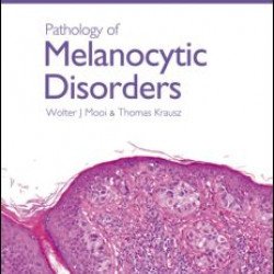 Pathology of Melanocytic Disorders 2ed Pathology of Melanocytic Disorders 2ed