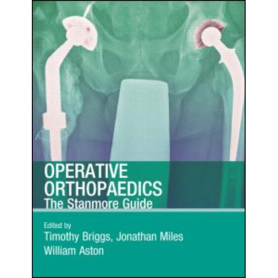Operative Orthopaedics: The Stanmore Guide Operative Orthopaedics: The Stanmore Guide