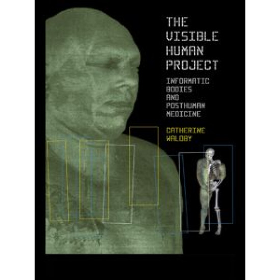 The Visible Human Project