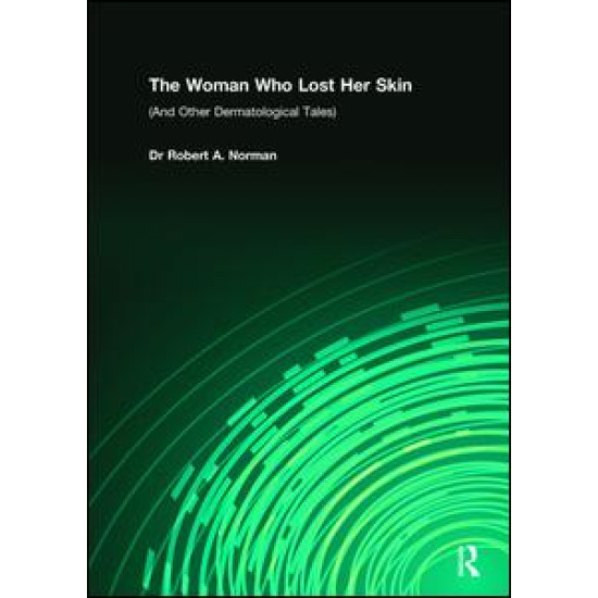 The Woman Who Lost Her Skin
