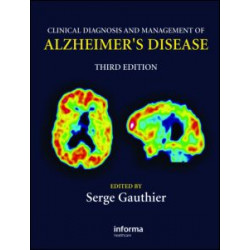 Clinical Diagnosis and Management of Alzheimer's Disease Clinical Diagnosis and Management of Alzheimer's Disease