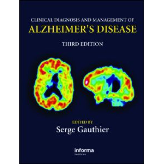 Clinical Diagnosis and Management of Alzheimer's Disease