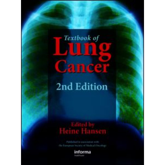 Textbook of Lung Cancer Textbook of Lung Cancer