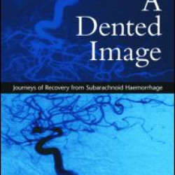 A Dented Image A Dented Image