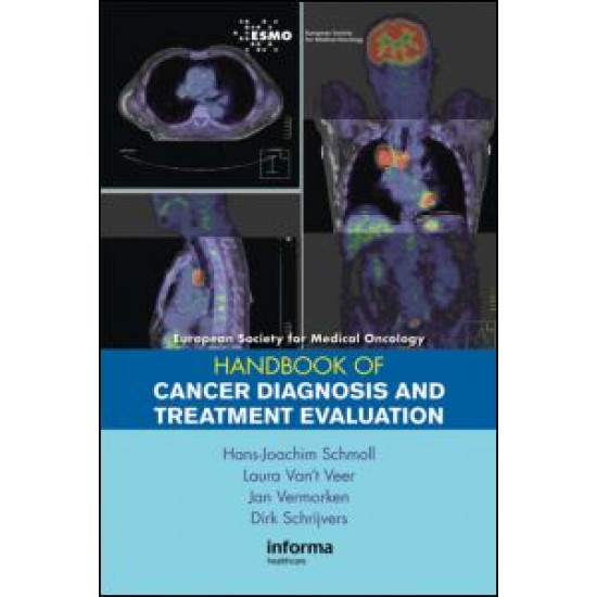 ESMO Handbook of Cancer Diagnosis and Treatment Evaluation ESMO Handbook of Cancer Diagnosis and Treatment Evaluation