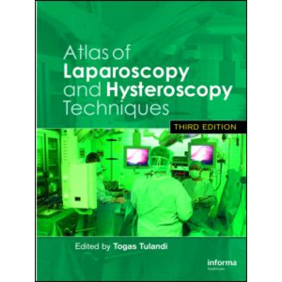 Atlas of Laparoscopy and Hysteroscopy Techniques