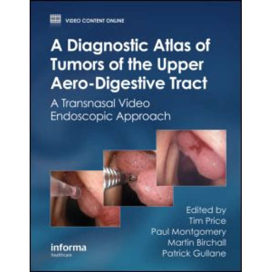 A Diagnostic Atlas of Tumors of the Upper Aero-Digestive Tract A Diagnostic Atlas of Tumors of the Upper Aero-Digestive Tract