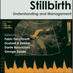 Stillbirth Stillbirth