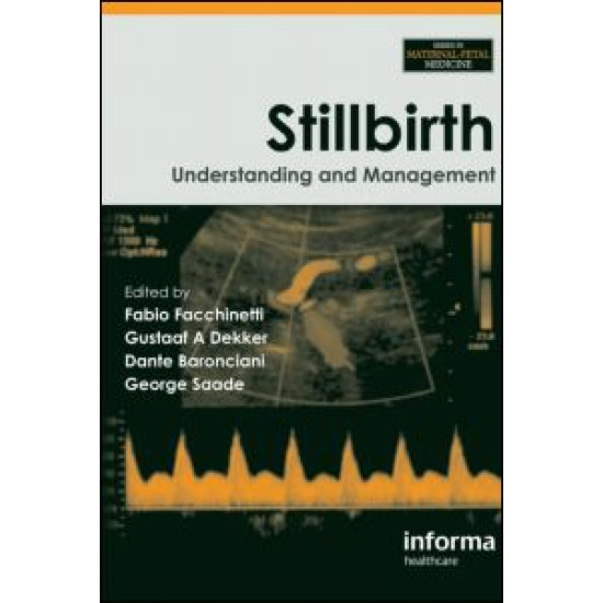 Stillbirth