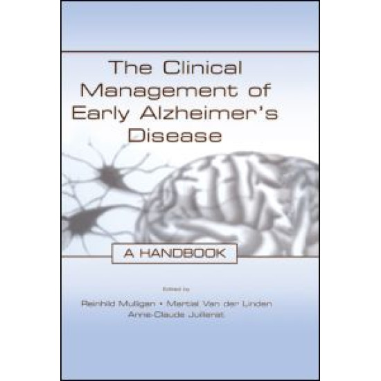 The Clinical Management of Early Alzheimer's Disease