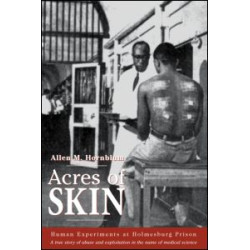 Acres of Skin Acres of Skin