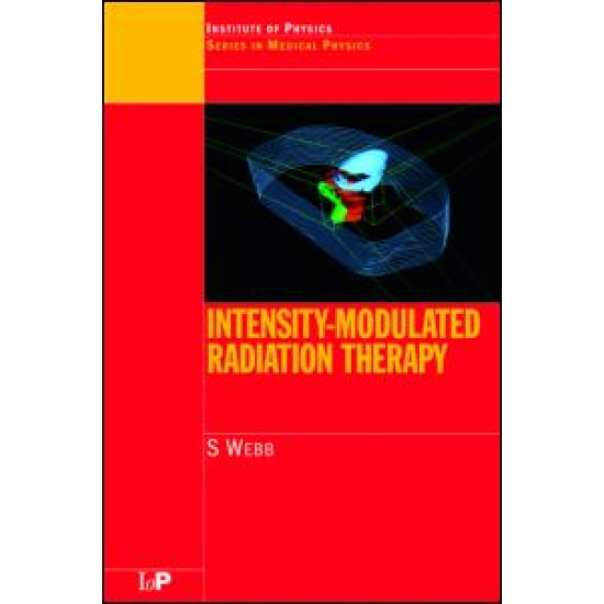 Intensity-Modulated Radiation Therapy Intensity-Modulated Radiation Therapy