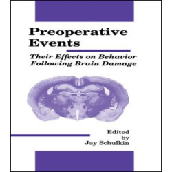 Preoperative Events