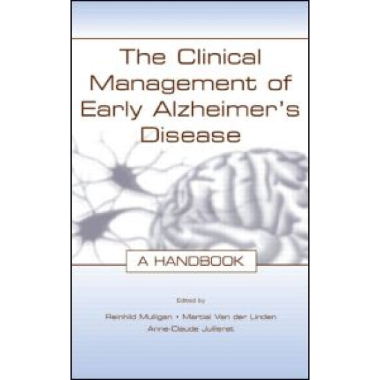The Clinical Management of Early Alzheimer's Disease