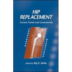 Hip Replacement
