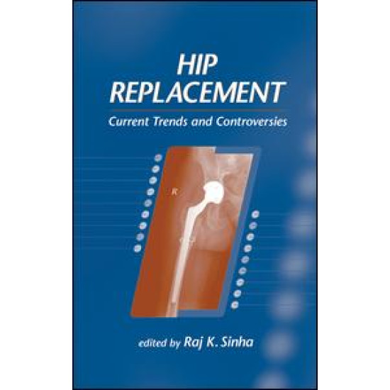 Hip Replacement Hip Replacement