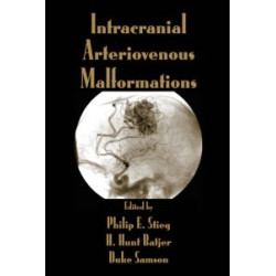 Intracranial Arteriovenous Malformations