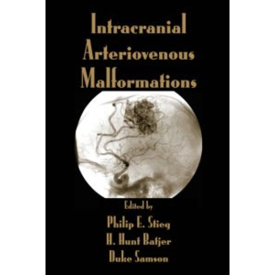 Intracranial Arteriovenous Malformations