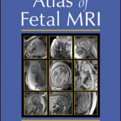 Atlas of Fetal MRI
