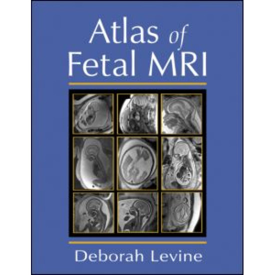 Atlas of Fetal MRI