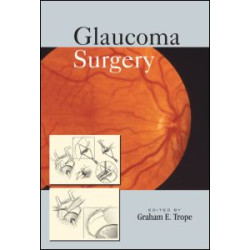 Glaucoma Surgery Glaucoma Surgery