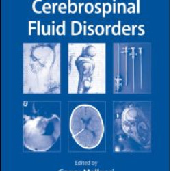 Cerebrospinal Fluid Disorders Cerebrospinal Fluid Disorders