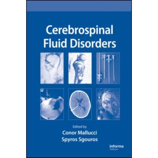 Cerebrospinal Fluid Disorders Cerebrospinal Fluid Disorders