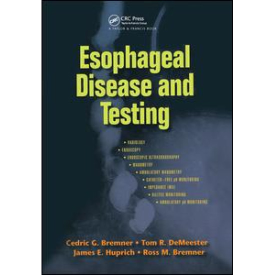 Esophageal Disease and Testing