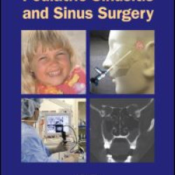 Pediatric Sinusitis and Sinus Surgery Pediatric Sinusitis and Sinus Surgery