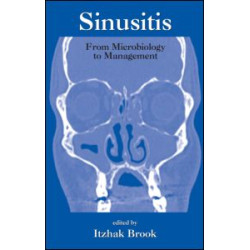 Sinusitis