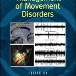 Surgical Management of Movement Disorders