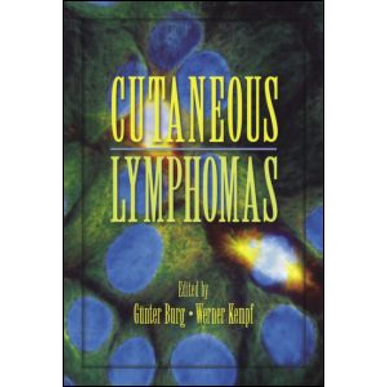 Cutaneous Lymphomas