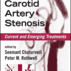 Carotid Artery Stenosis Carotid Artery Stenosis