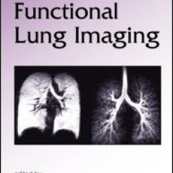 Functional Lung Imaging Functional Lung Imaging