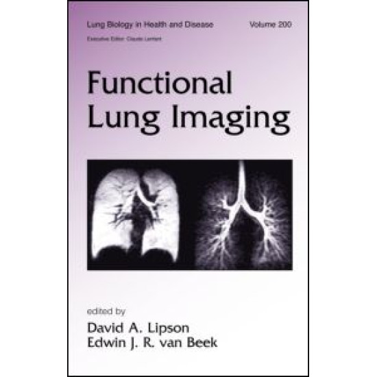 Functional Lung Imaging Functional Lung Imaging