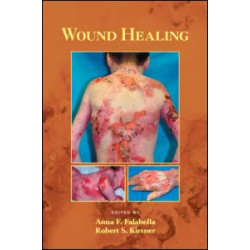 Wound Healing Wound Healing