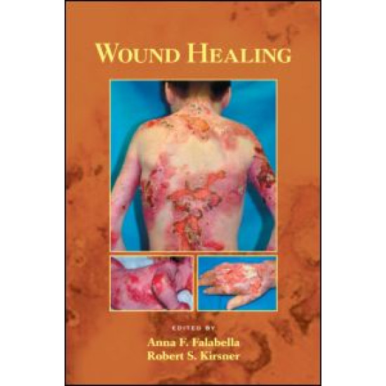 Wound Healing Wound Healing