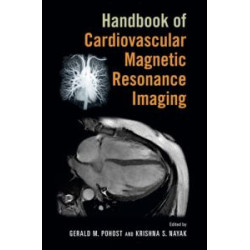 Handbook of Cardiovascular Magnetic Resonance Imaging