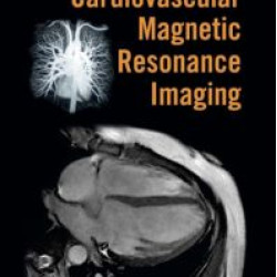 Handbook of Cardiovascular Magnetic Resonance Imaging