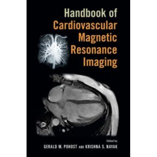 Handbook of Cardiovascular Magnetic Resonance Imaging