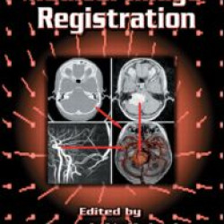 Medical Image Registration Medical Image Registration