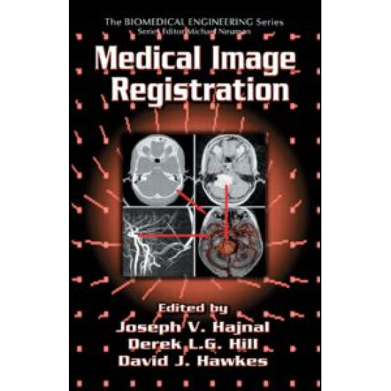 Medical Image Registration Medical Image Registration