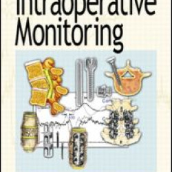 A Concise Guide to Intraoperative Monitoring A Concise Guide to Intraoperative Monitoring