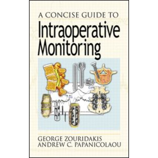 A Concise Guide to Intraoperative Monitoring A Concise Guide to Intraoperative Monitoring