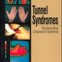 Tunnel Syndromes
