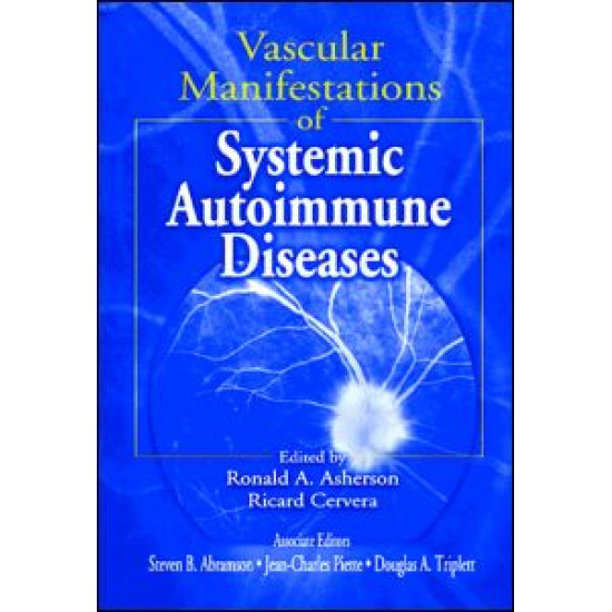 Vascular Manifestations of Systemic Autoimmune Diseases Vascular Manifestations of Systemic Autoimmune Diseases