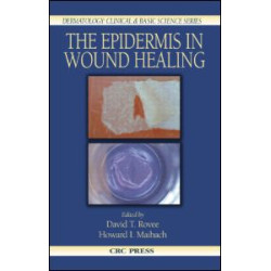 The Epidermis in Wound Healing