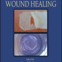 The Epidermis in Wound Healing