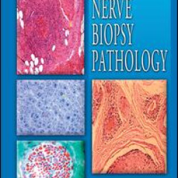 Color Atlas of Nerve Biopsy Pathology Color Atlas of Nerve Biopsy Pathology