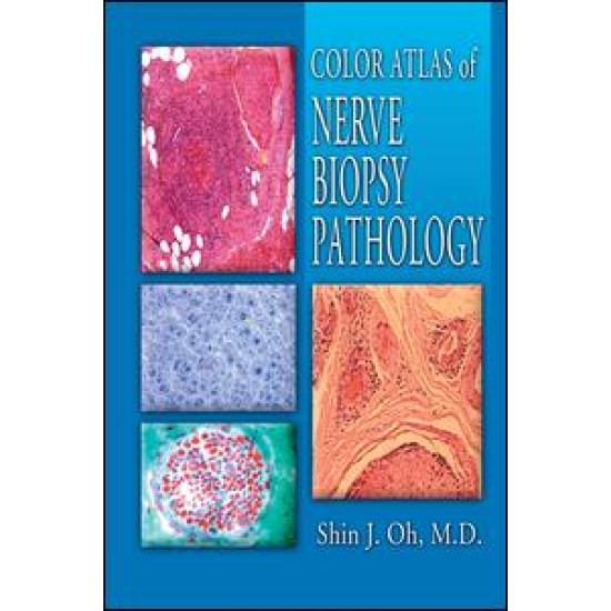 Color Atlas of Nerve Biopsy Pathology Color Atlas of Nerve Biopsy Pathology